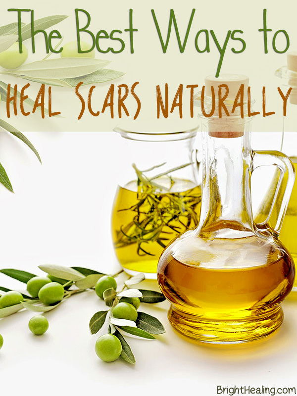 The-Best-Ways-to-Heal-Scars-Naturally