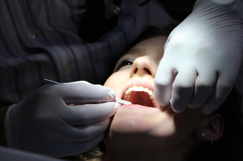 teeth inspection